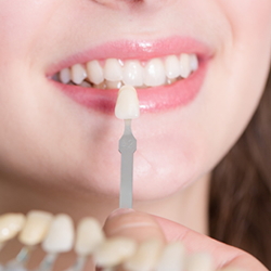 ホワイトニングイメージ